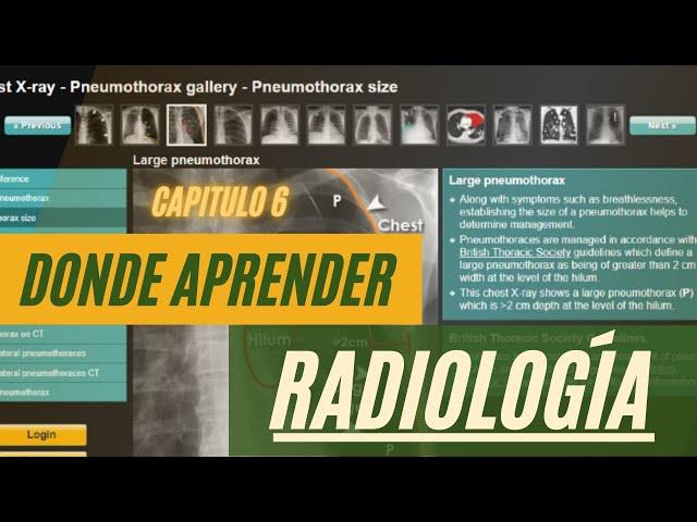 ▶️🟡Capitulo 6️⃣ DONDE APRENDER RADIOLOGÍA