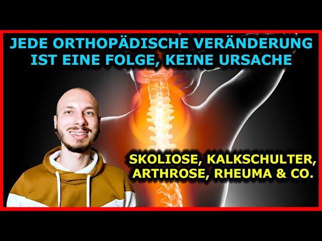 Jede ORTHOPÄDISCHE VERÄNDERUNG (Skoliose, Arthrose, Kalkschulter, Rheuma) ist FOLGE, nicht URSACHE