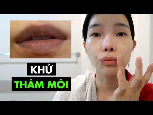 24 ngày khử thâm môi đơn giản dễ làm tại nhà