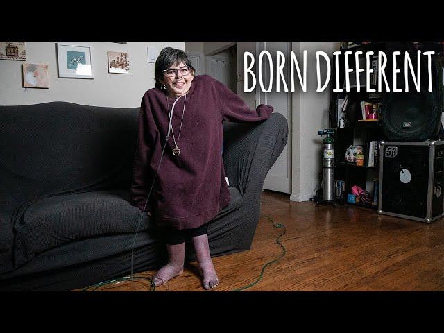 I Was Born With A Third Arm On My Head | BORN DIFFERENT