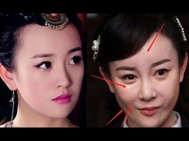 15 Chinese Actors Who RUINED Their Faces With Too Much Plastic Surgery