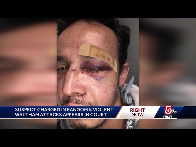 Waltham victim says he forgives accused attacker