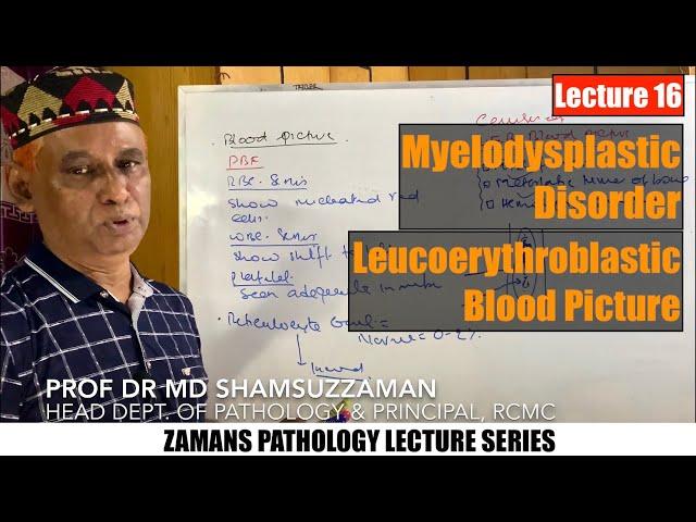 Hematology: Lecture 16 | Myelodysplastic Disorder & Leucoerythroblastic Blood Picture