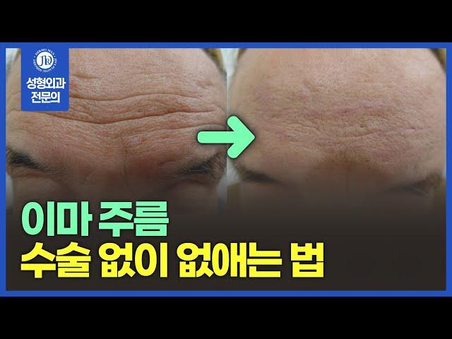 이마 주름이 생기는 원인부터 수술 없이 없애는 방법