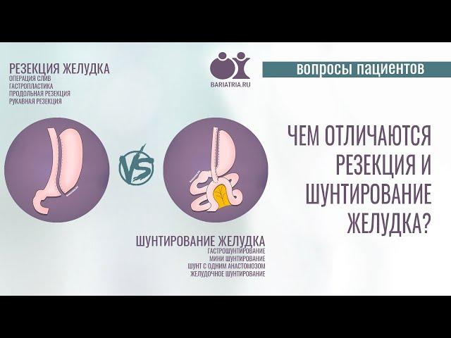 Чем отличаются резекция желудка и шунтирование желудка