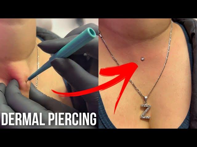 Neck Dermal Piercing  by Underground Tattoos Watford #piercing #dermalpiercing