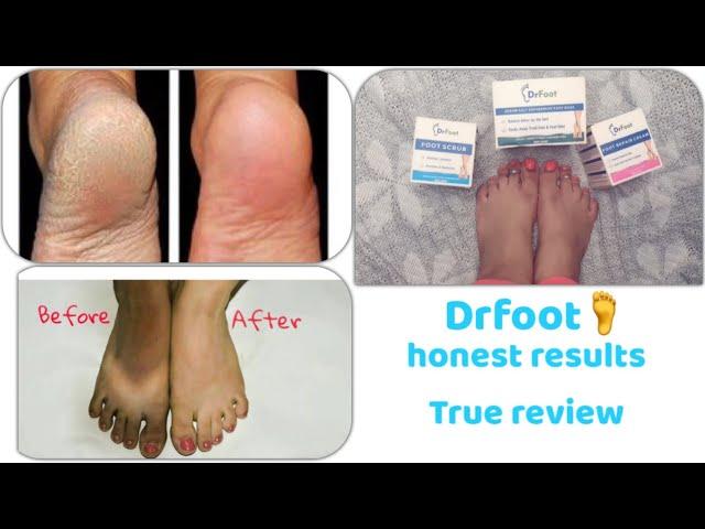 Drfoot spa range review|Say bye-bye to cracked heels ,bad odors,permanently|get smooth and soft feet