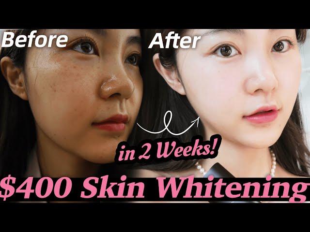 REAL EXPERIENCE: k-pop idols whitening treatment! Unexpected results!  | Lyn Beauty