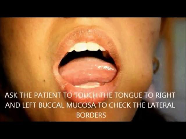 Clinical Examination of the Tongue