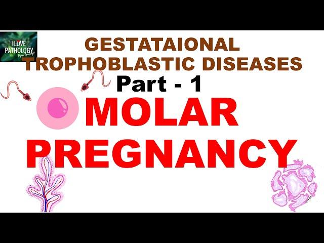 Gestational trophoblastic diseases: Part 1: Complete and Partial Hydatidiform Moles