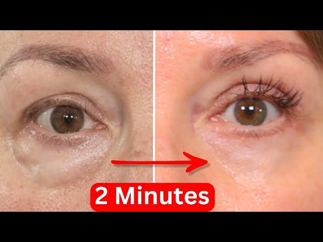 How To Get Rid Of Eye Bags Instantly Over 50