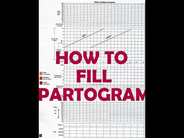 HOW TO FILL PARTOGRAM - VERY EASY