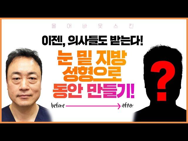 피부과 전문의도 받는다. 눈 밑 지방 제거의 결과는?