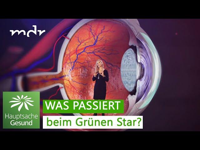 Grüner Star - schmerzlos und heimtückisch | Hauptsache gesund | MDR