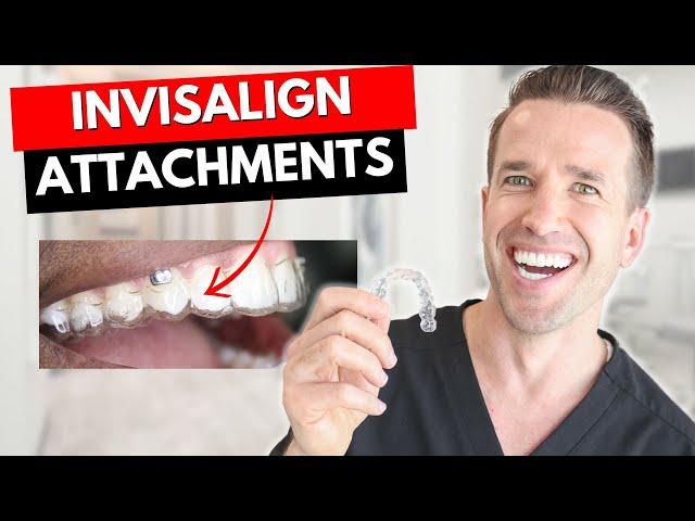 Don't get Invisalign Attachments Before watching this! | Dr. Nate