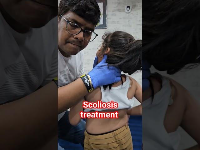 Scoliosis treatment #drrajneeshkant