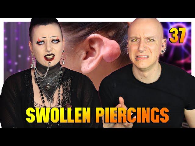 Reacting To Piercing Keloids & Hypertrophic Scars (ft.Toxic Tears) | Piercings Gone Wrong 37 | Roly