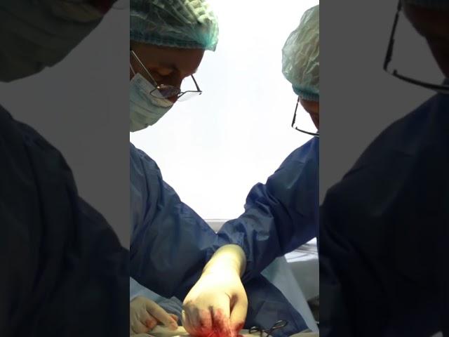 #doctors #surgery #operation  Злагоджена робота лікарів під час операції
