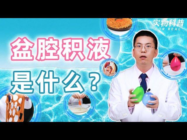 【硬核科普】人人都有的盆腔积液，到底是什么？