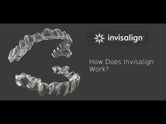 Invisalign clear aligners - how it works? | www.bangkokbraces.com