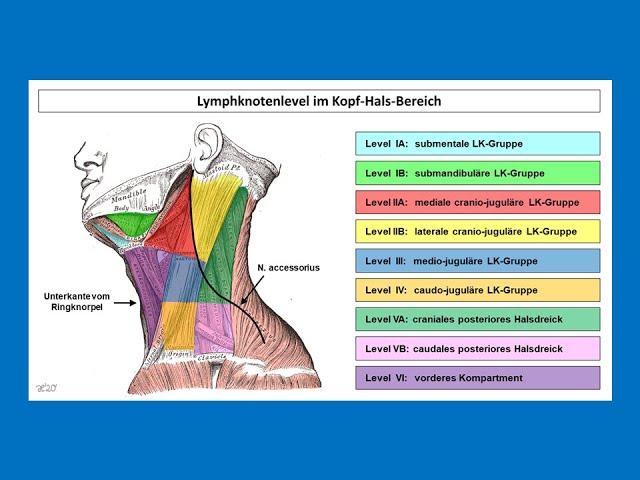 Lymphknotenlevel im Kopf-Hals-Bereich | Strahlentherapie Prof. Hilke Vorwerk