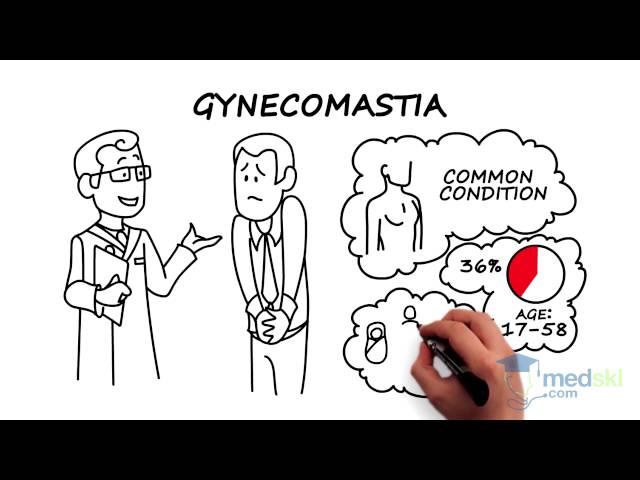 how to get rid of gynecomastia without surgery