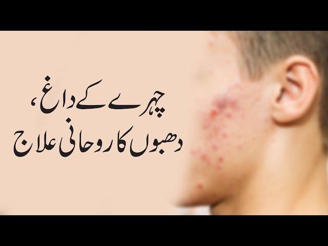 Chehre Ke Dagh Dhabbon Ka Rohani Ilaj - Islamic Spiritual Medicine - Pimples Freckles - Istikhara