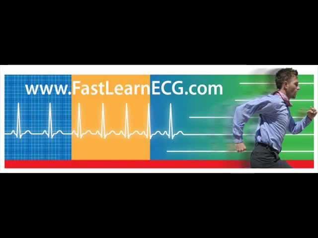 Master the basics of a normal 12 lead ECG or EKG (first workshop)