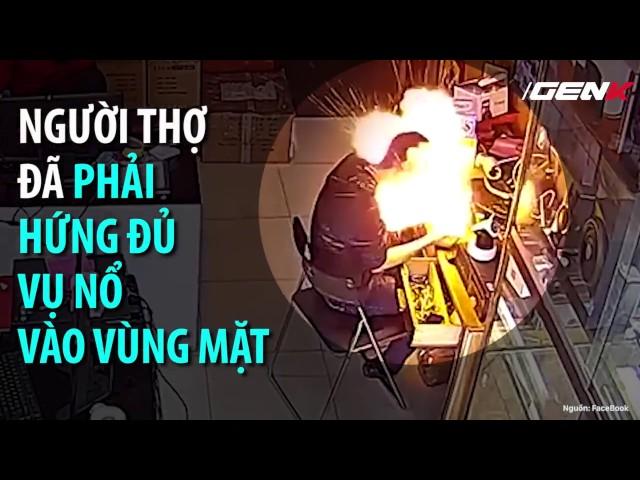 Tai nạn khôn lường vì xem thường sức công phá của pin điện thoại - Nguyễn Kim