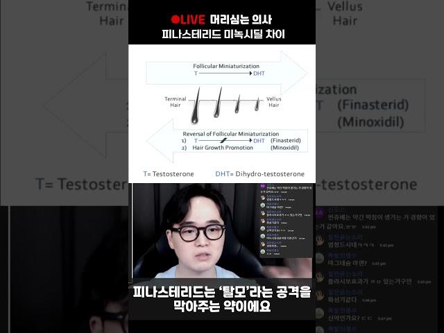 미녹시딜 VS 피나스테리드