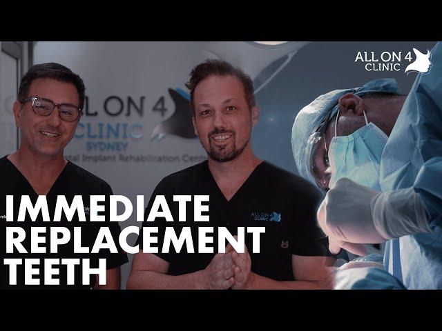 All On 4 Plus® | Behind the Smile (S01/E03)| Immediate Replacement Teeth