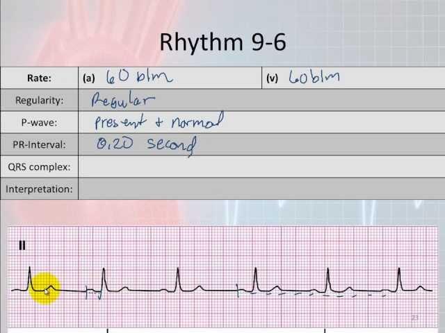 Basic Electrophysiology, part 6 - Sinus Node Rhythms