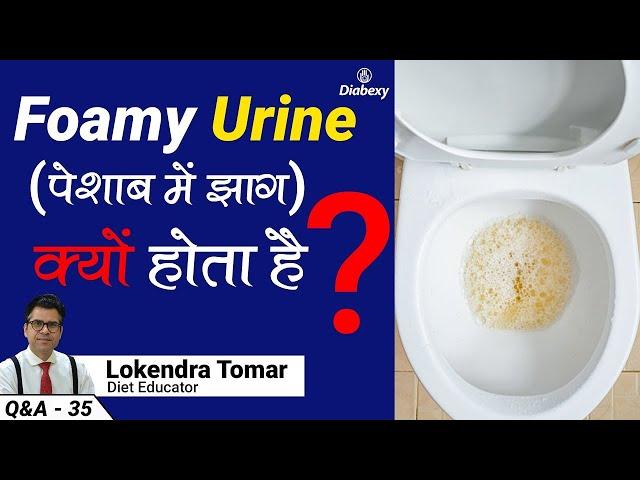 What are the Reasons of Foamy Urine Among Diabetic Patients | Diabexy Q&A 35