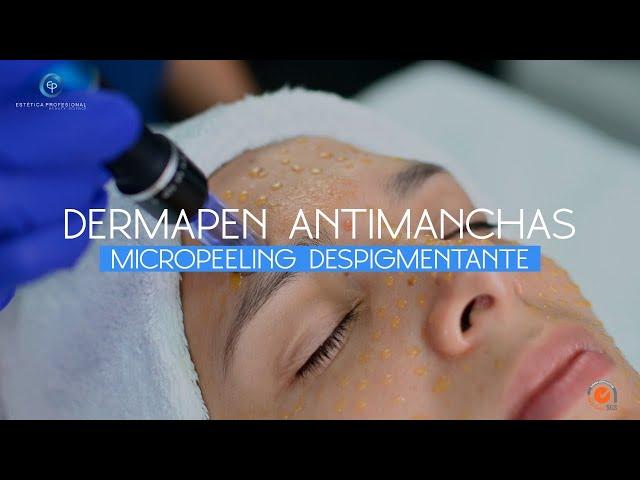 DERMAPEN ANTIMANCHAS MICROPEELING DESPIGMENTANTE l EP ESTETICA PROFESIONAL