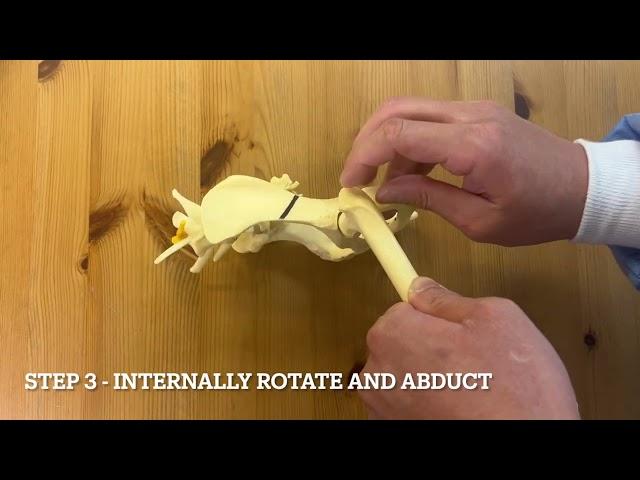 Reduction of  a craniodorsal hip luxation dog