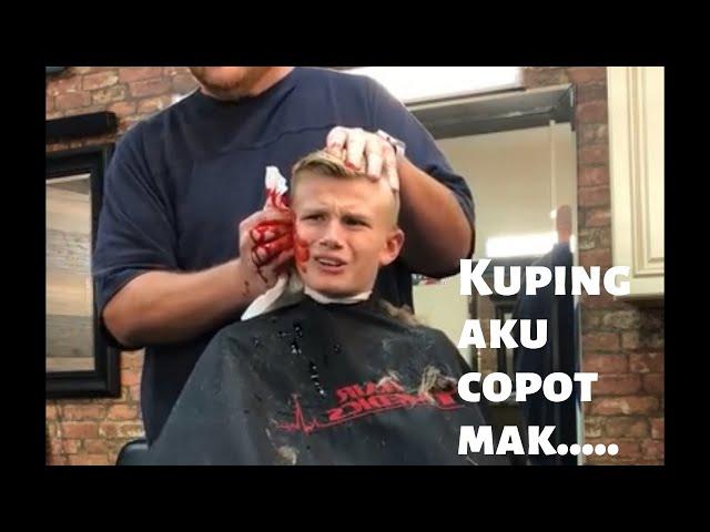 Bocah Kepotong Kupingnya saat Potong Rambut Prank