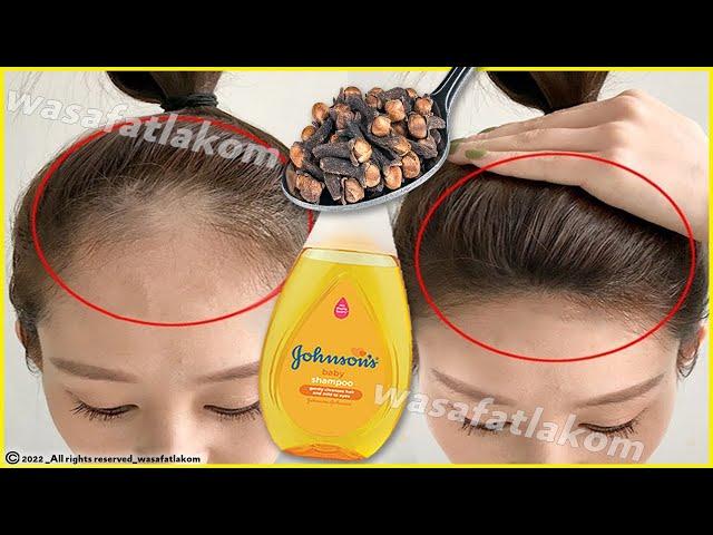 Put these ingredients in your shampoo,  it accelerates hair growth and treats baldness