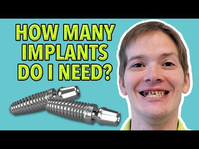 How Many Implants Should I Get?