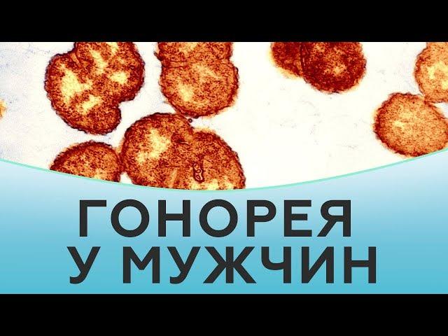 Гонорея у мужчин. Лечение гонореи