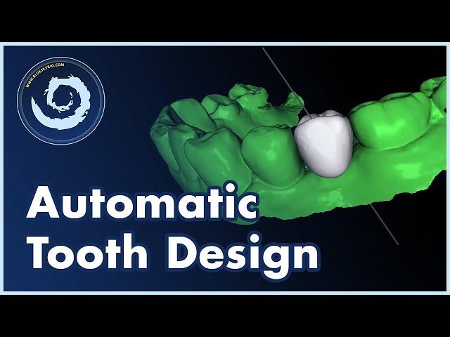 BSP V4.13: Automatic AI Tooth Design Now Available in Blue Sky Plan