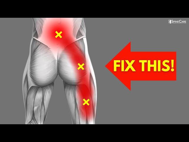 How to INSTANTLY Fix Pinched Nerve Pain in the Back and Leg