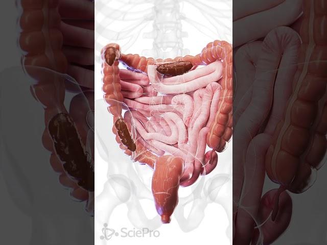  Understanding Constipation: A Closer Look at the Colon  #anatomy