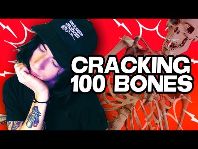 Cracking 100 Bones *World Record*