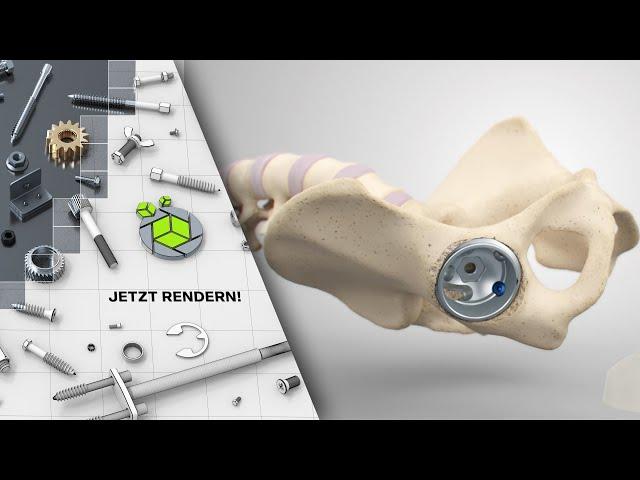 DEJO-Media - Aesculap - Plasmafit® - Revision - 3D-Animation - Referenz