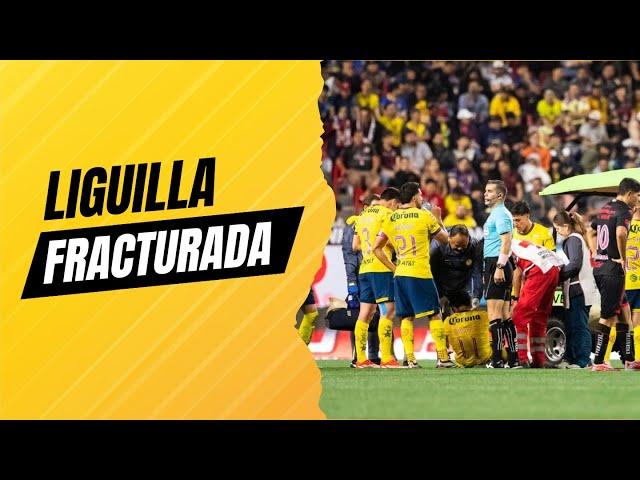 Liguilla fracturada: Más lesionados y dudas con América