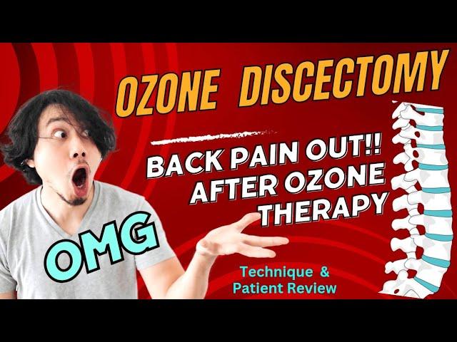 Ozone Discectomy | Lumbar Ozone Discectomy Technique | Patient Review 