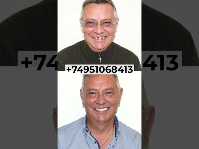 Идеальная улыбка всего за 3 дня = 339 000 руб! #клиника #dentist  #estetus #доктор #beforeandafter