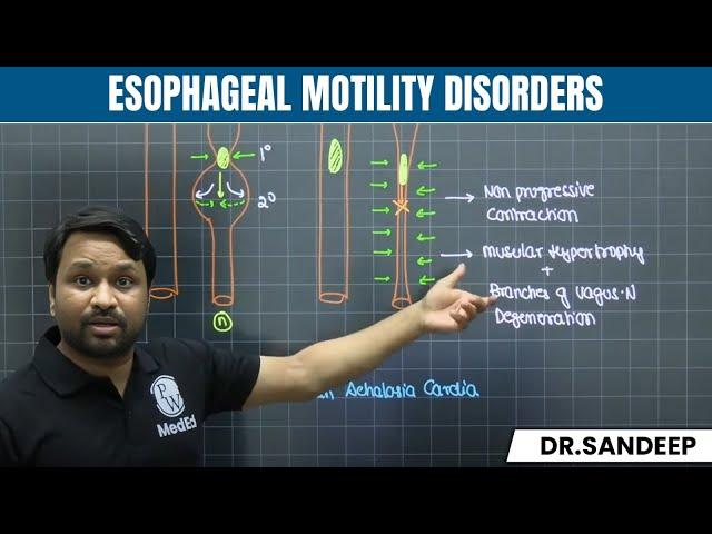 Esophageal Motility Disorders | Surgery | Bailey learned with Dr. Sandeep | PW MedEd