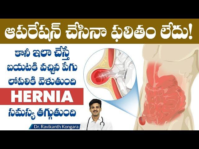 Causes of Hernia  | How to Cure Hernia Without Operation | Obesity and Asthma | Dr.Ravikanth Kongara