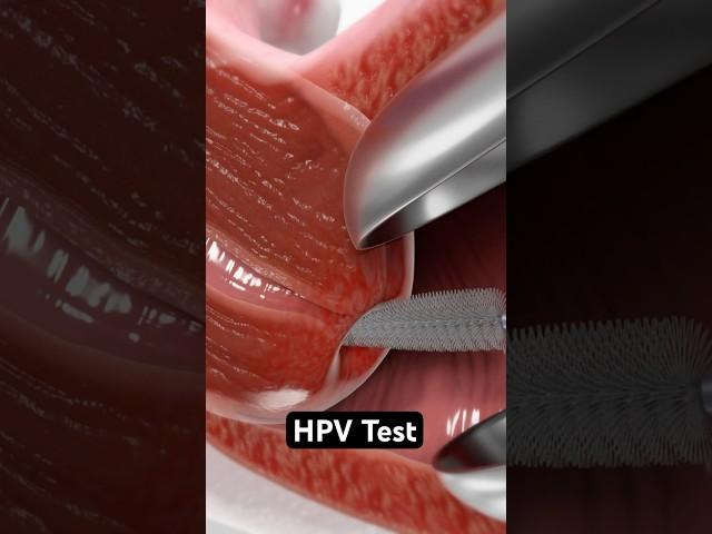 HPV Test (3D Animation)